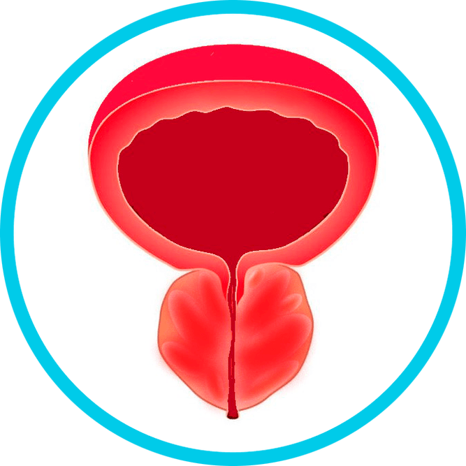 Simptomi prostatitisa